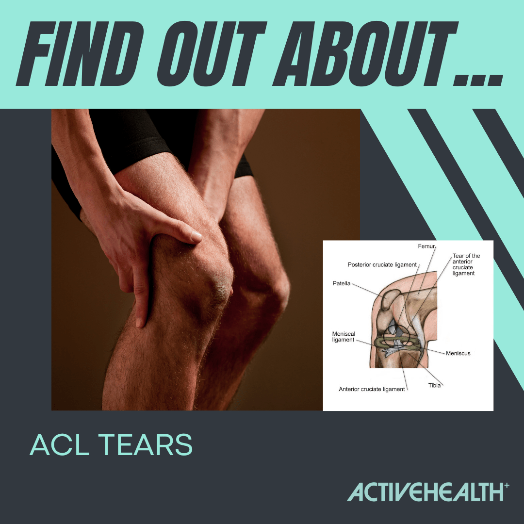graphic with images of knees and text saying Find out about ACL tear