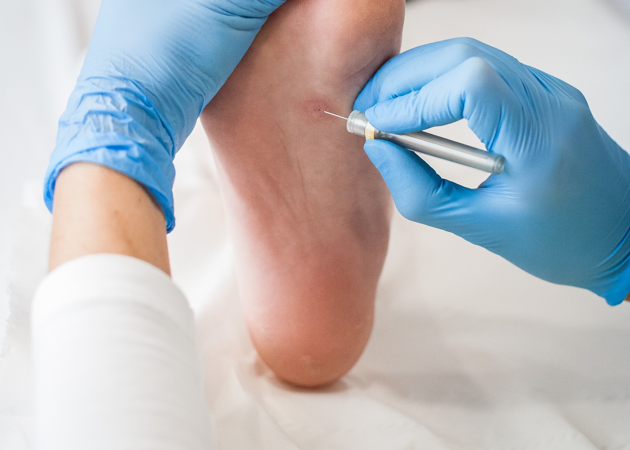 chiropody services at Active Health